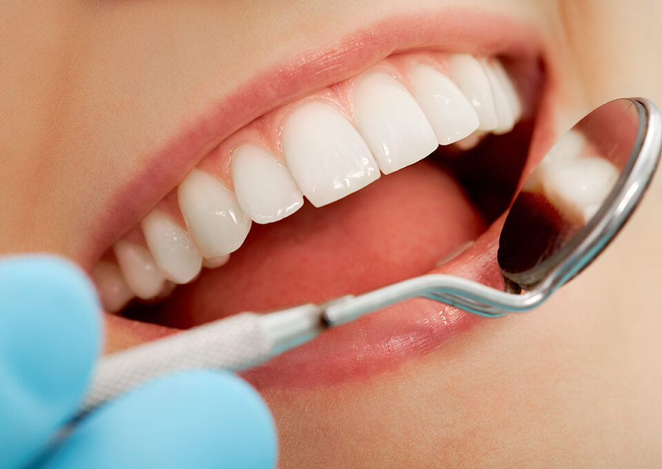 虫歯・歯周病の発症を防ぐ